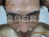 пưҽԺ